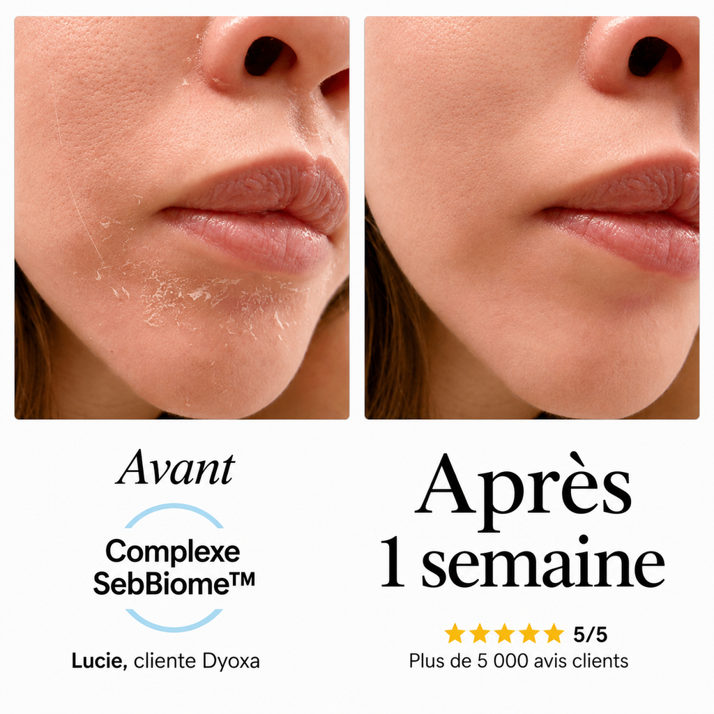 Sérum apaisant naturel Dyoxa
