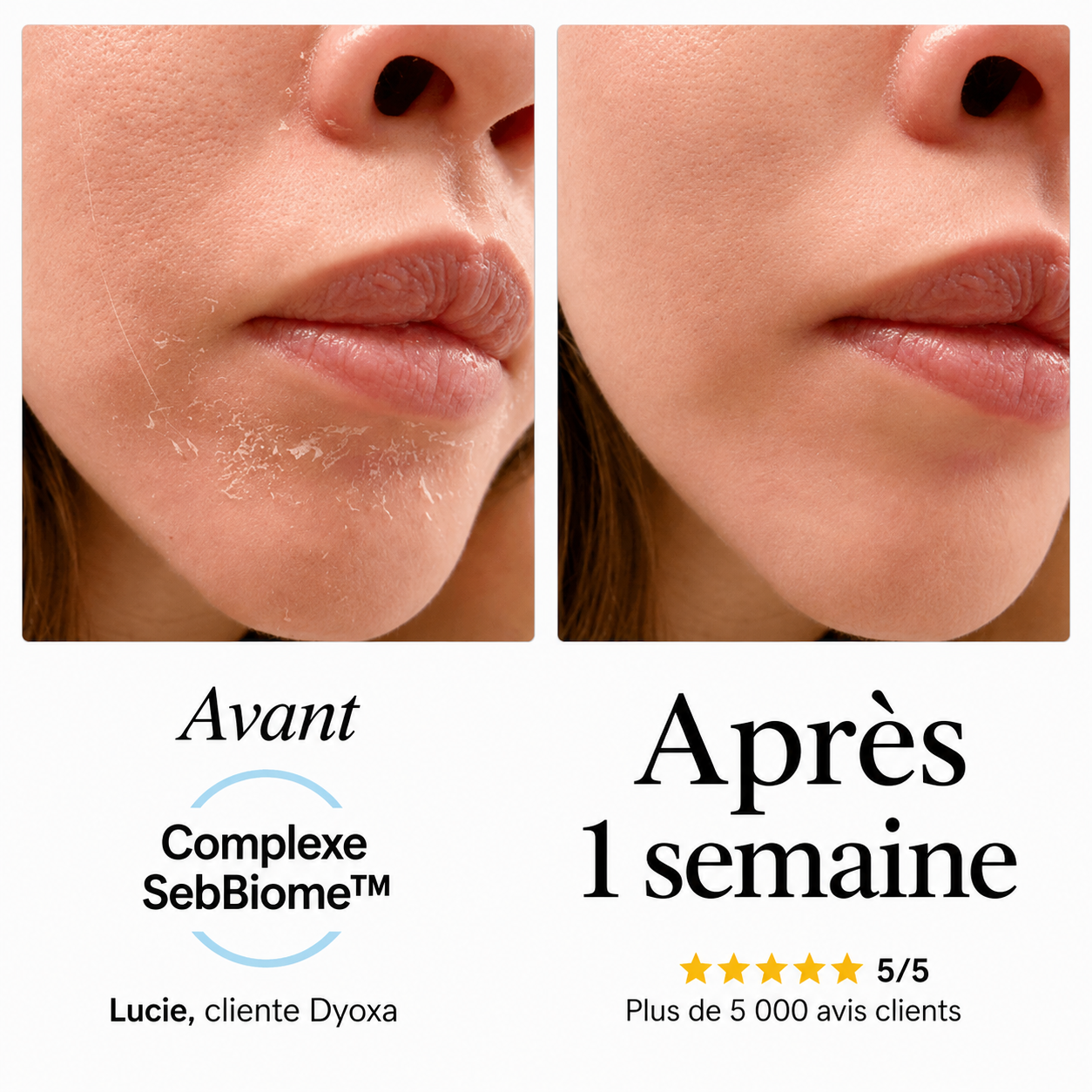 Sérum apaisant naturel Dyoxa