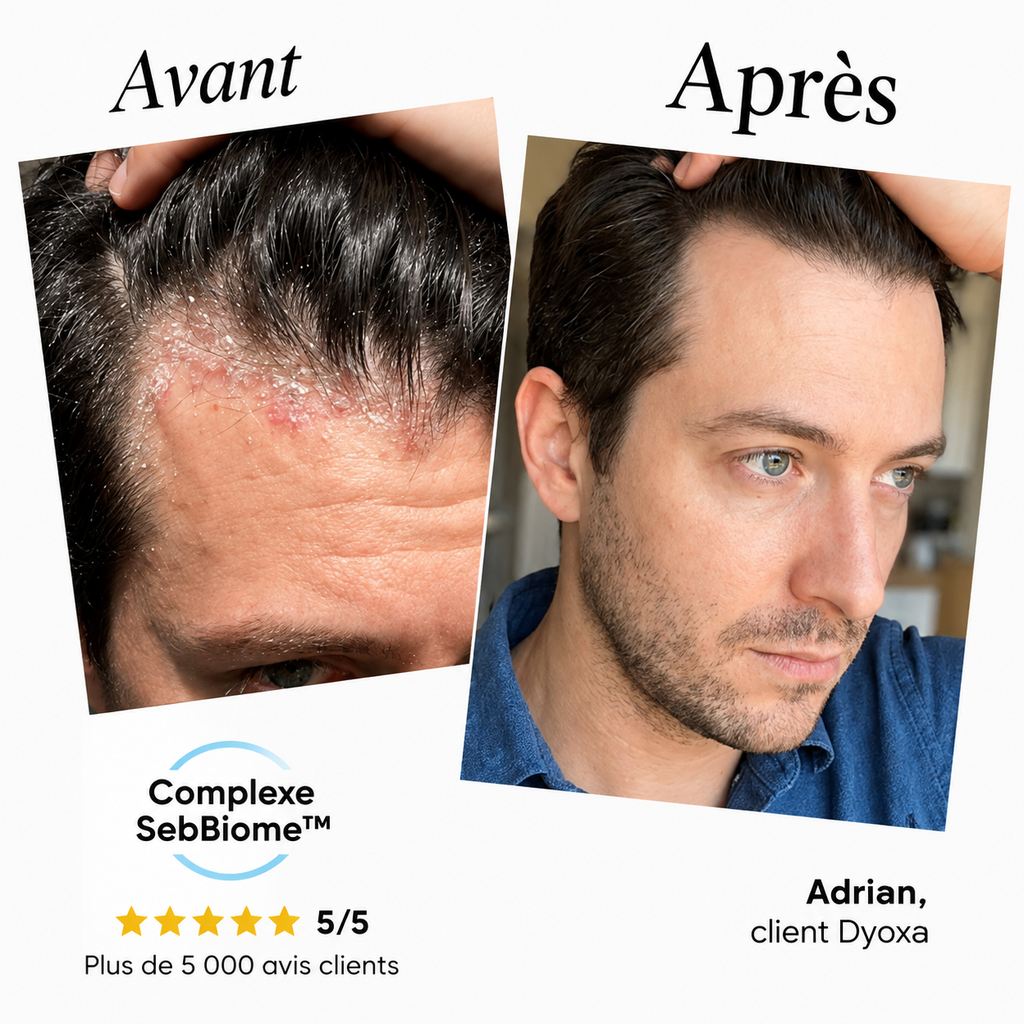 Sérum apaisant naturel Dyoxa