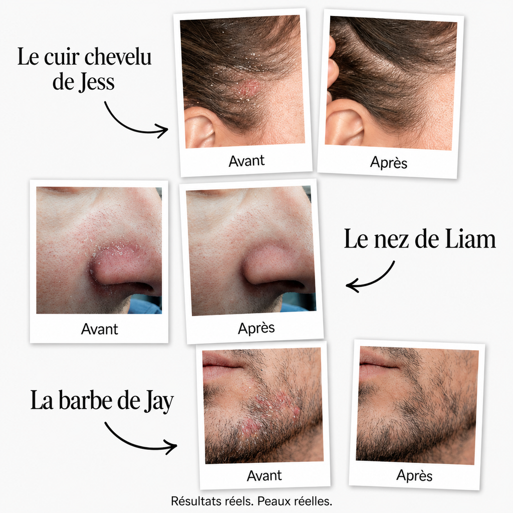Sérum apaisant naturel Dyoxa