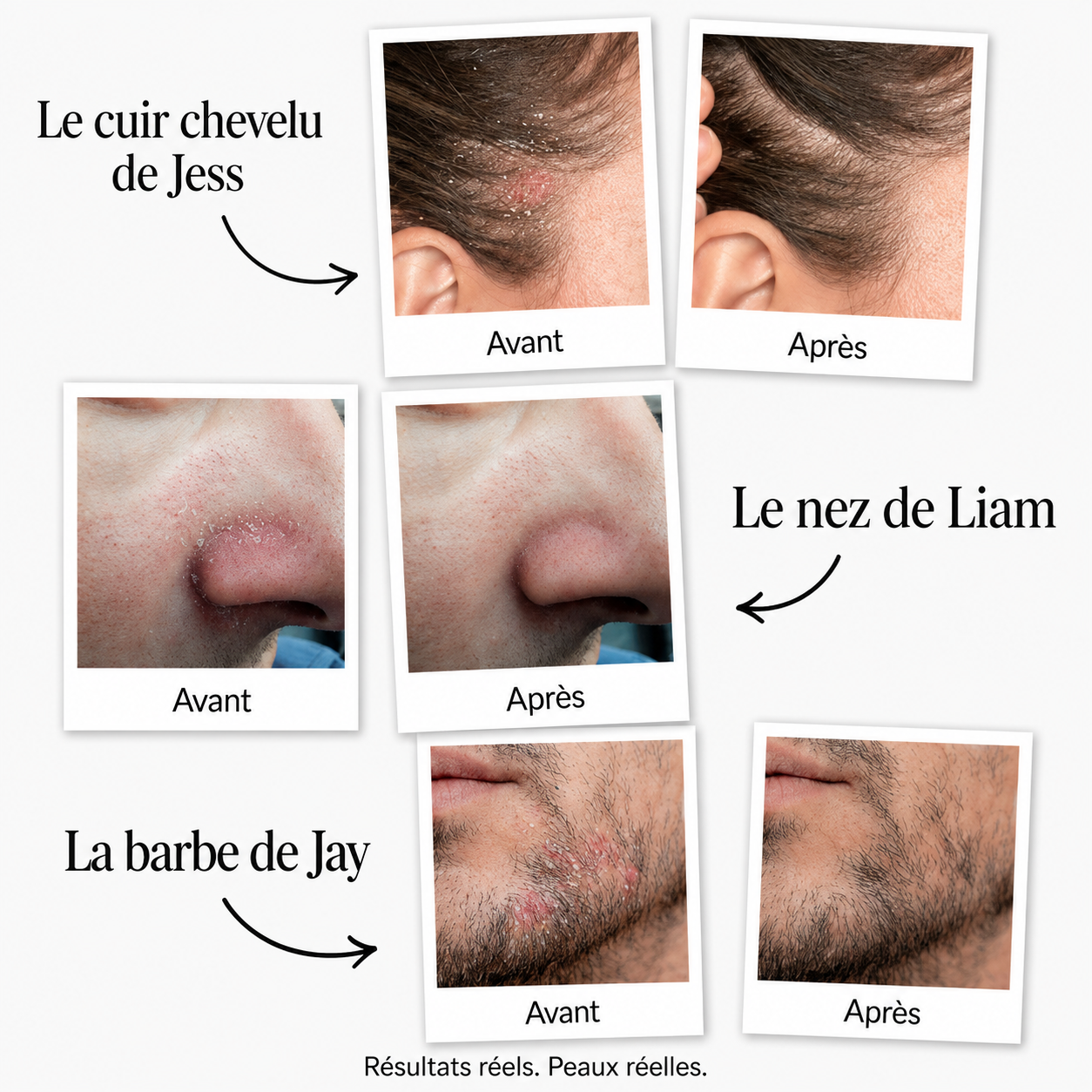 Sérum apaisant naturel Dyoxa